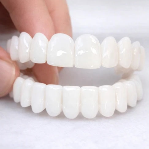 Facetas Dentárias Removíveis