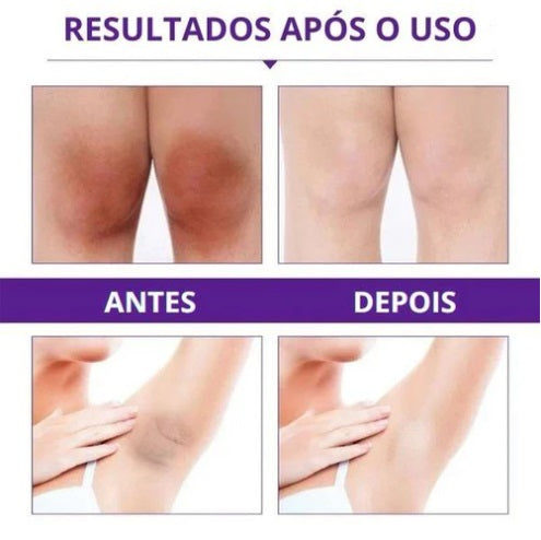 Creme Clareador Axila e Virilha